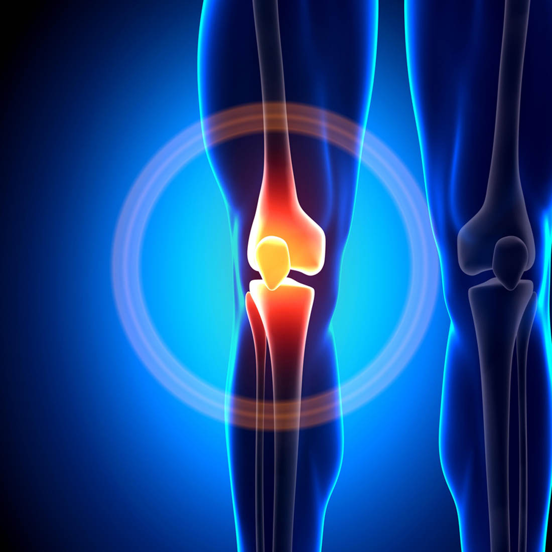 knee pain images